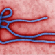 El ébola, un virus que puede viajar alrededor del mundo! es importante aprender esto viene fuerte miren todo