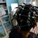 Estudio: La estimulación eléctrica del cerebro podría ayudar a salir de una depresión grave