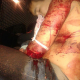 Video Fuerte Hombre fue atacado a machetazo Man with Machete Wound all Over the Body